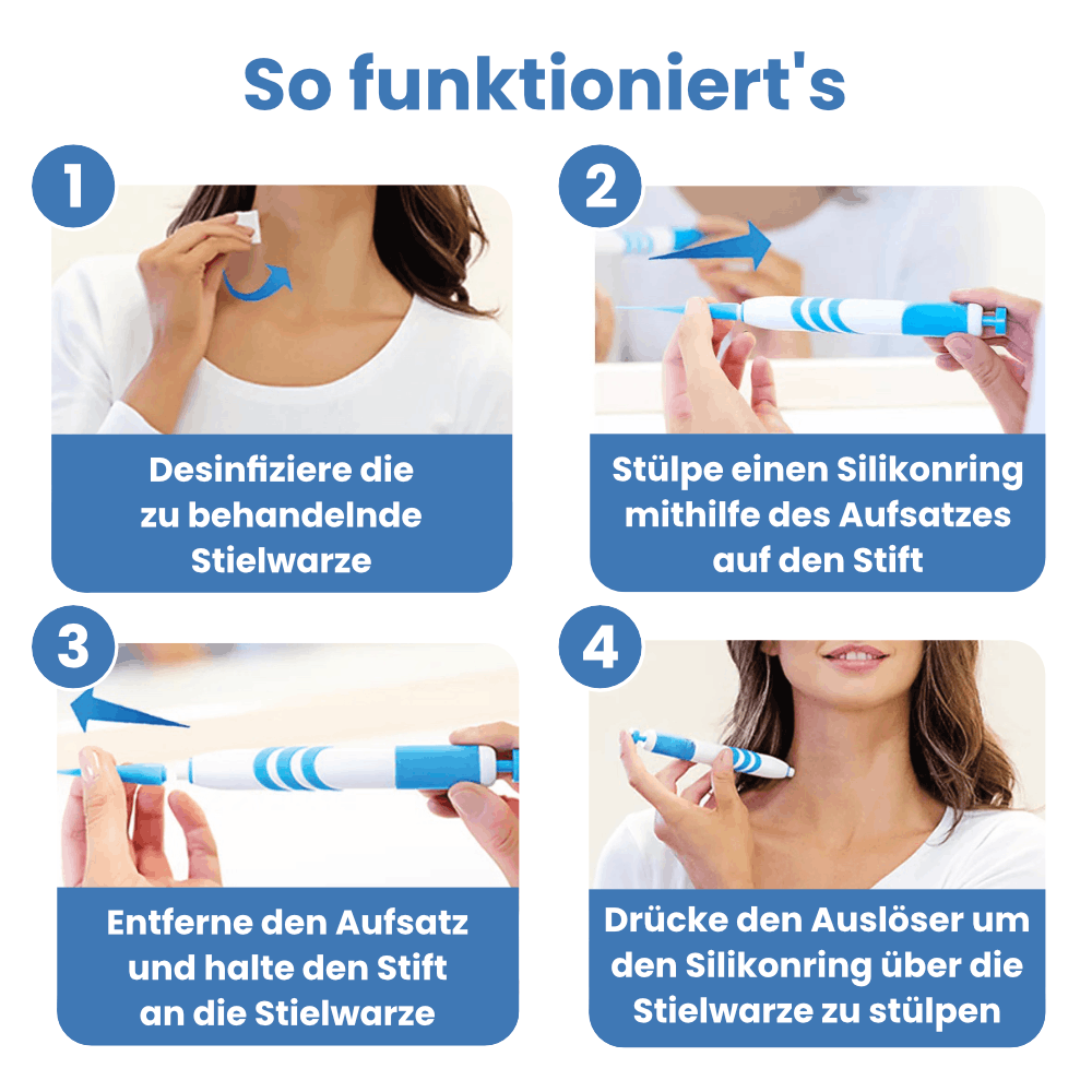 Schnell wirkende Warzenfrei-Lösung zur Entfernung von Stielwarzen – für jedermann