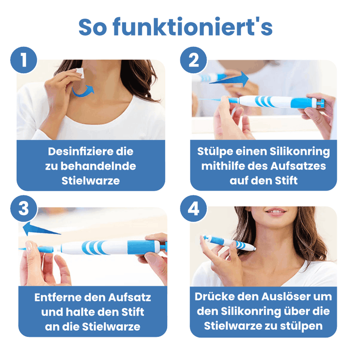 Schnell wirkende Warzenfrei-Lösung zur Entfernung von Stielwarzen – für jedermann