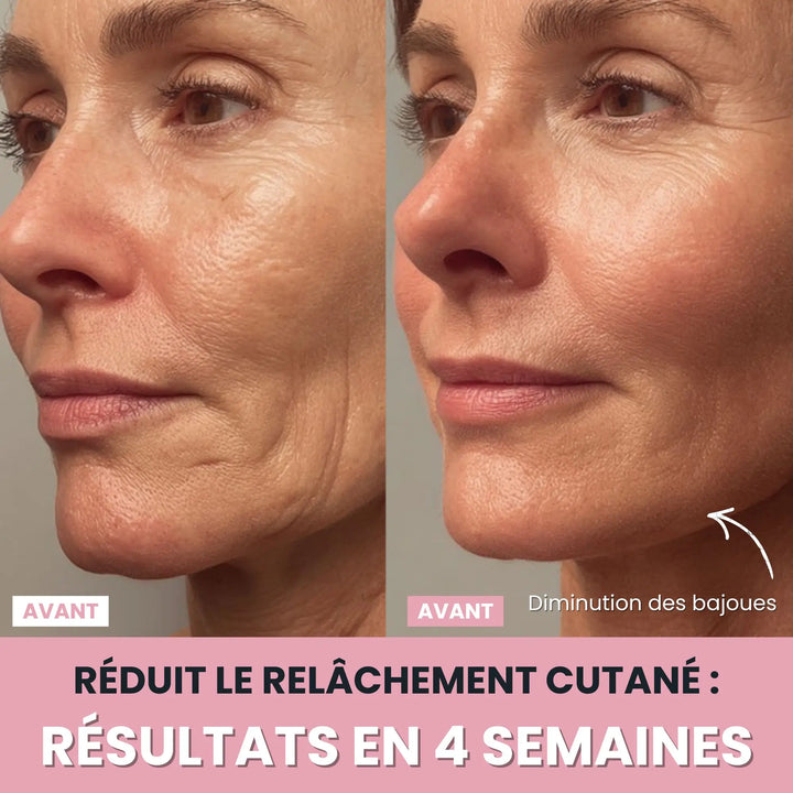 LenaSilk™: 7-in-1 LED-Gesichtsmodellierungsgerät
