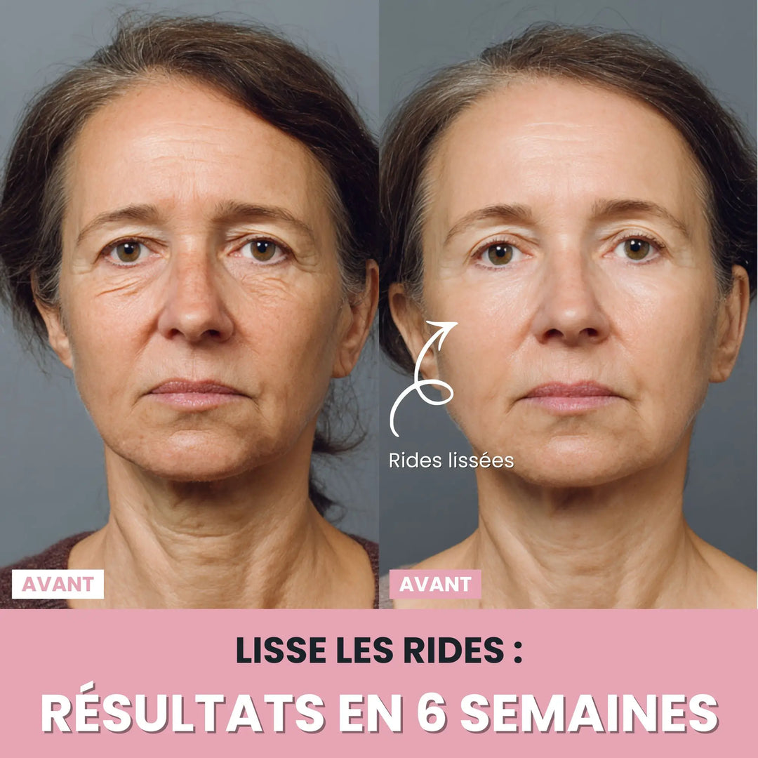 LenaSilk™: 7-in-1 LED-Gesichtsmodellierungsgerät