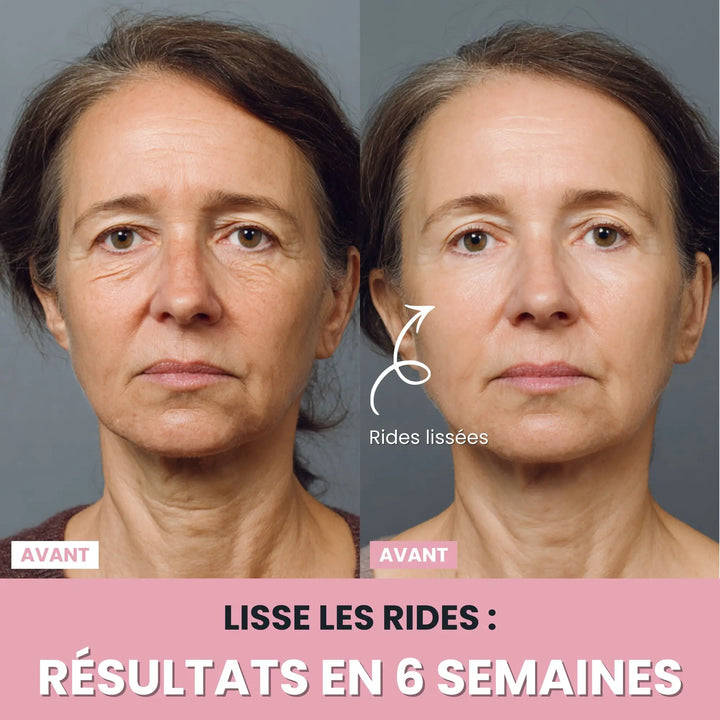LenaSilk™: 7-in-1 LED-Gesichtsmodellierungsgerät