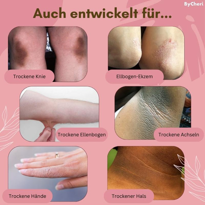 1+1 GRATIS TEMPORÄR | FootVitalize™ - Foot Finish Fußreparaturcreme