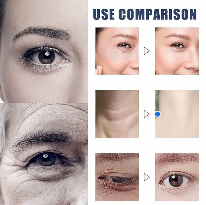DermalDeep™ – Füllt tiefe Falten sofort sichtbar und effektiv glättend, jugendlich [50% Rabatt]
