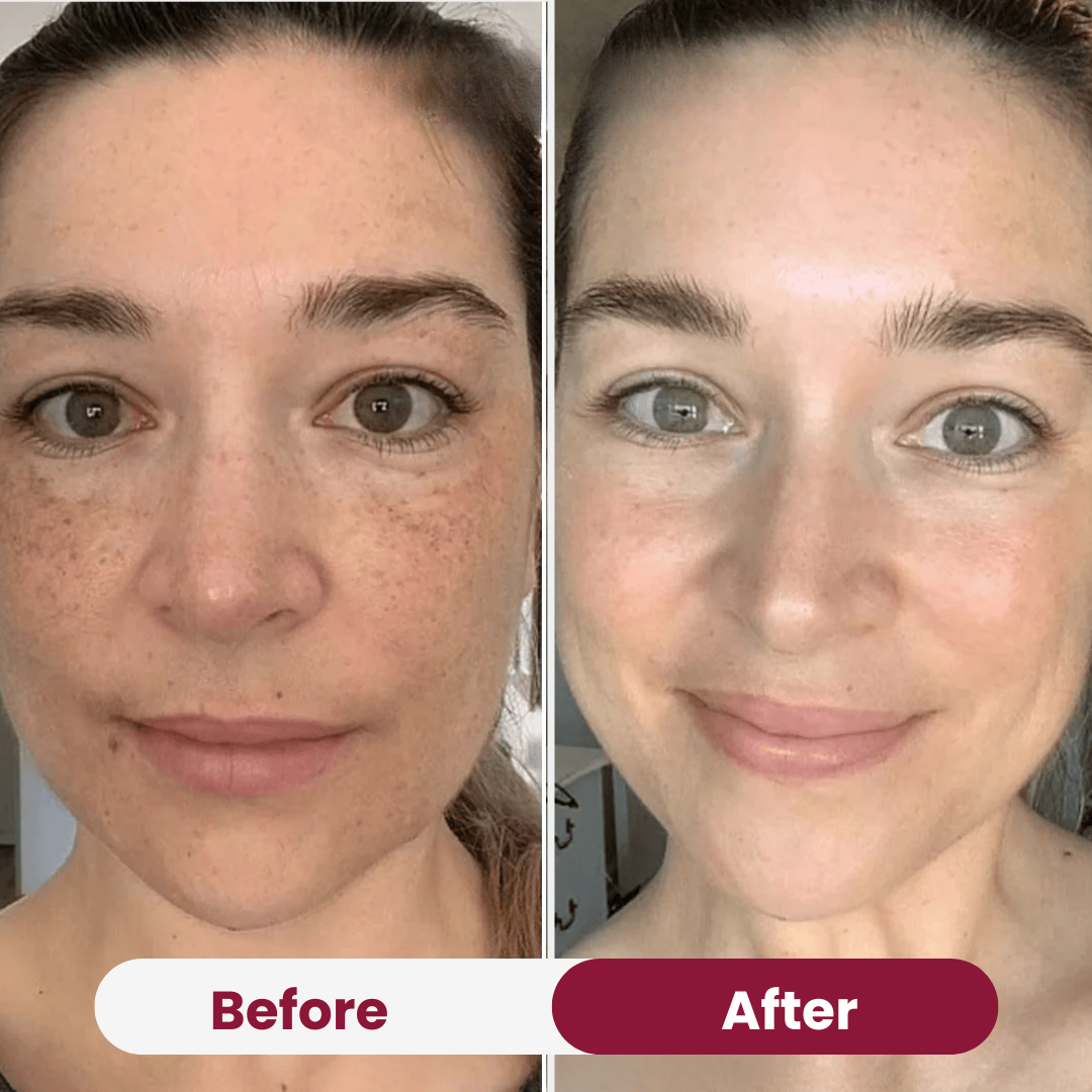 Bio-Kollagen-Maske