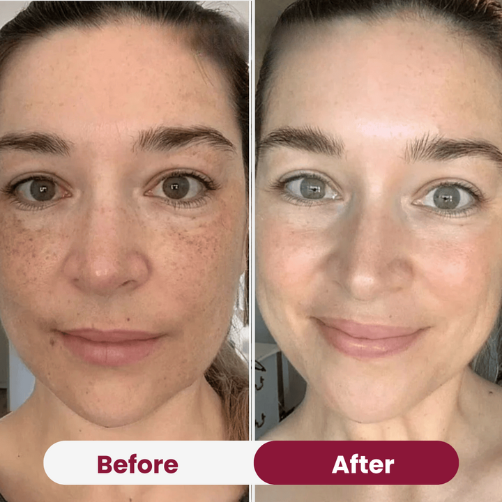 Bio-Kollagen-Maske