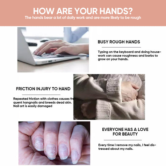 NailGrowth™ – Feuchtigkeitsspendende & stärkende Formel mit Vitamin E & Biotin, 5 g [50% Rabatt]