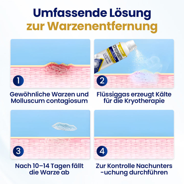 HautGlatt™ Kryo-Präzisionsspray gegen Hautunebenheiten