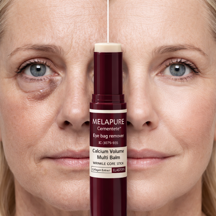 Augenbalsam gegen Tränensäcke