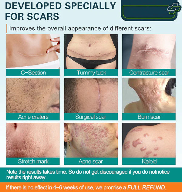 ScarSpray™ – Beruhigt gereizte, empfindliche Haut schnell und effektiv [50 % Rabatt]