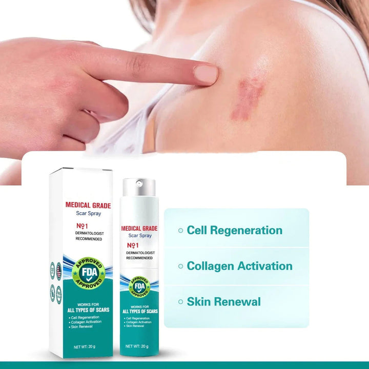 ScarSpray™ – Beruhigt gereizte, empfindliche Haut schnell und effektiv [50 % Rabatt]