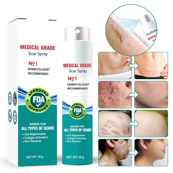 ScarSpray™ – Beruhigt gereizte, empfindliche Haut schnell und effektiv [50 % Rabatt]