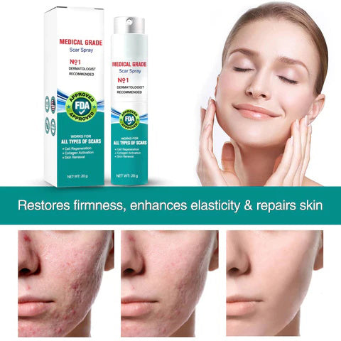 ScarSpray™ – Beruhigt gereizte, empfindliche Haut schnell und effektiv [50 % Rabatt]