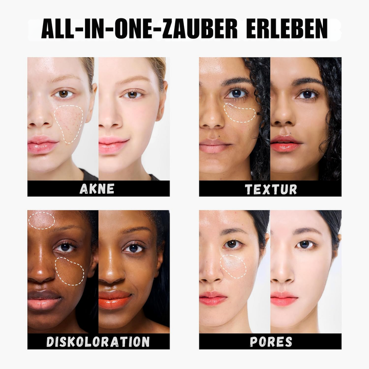 Tfit™ – Dreifarbiger Concealer, deckend, langanhaltend, makellos & strahlend [1 + 1 Gratis]