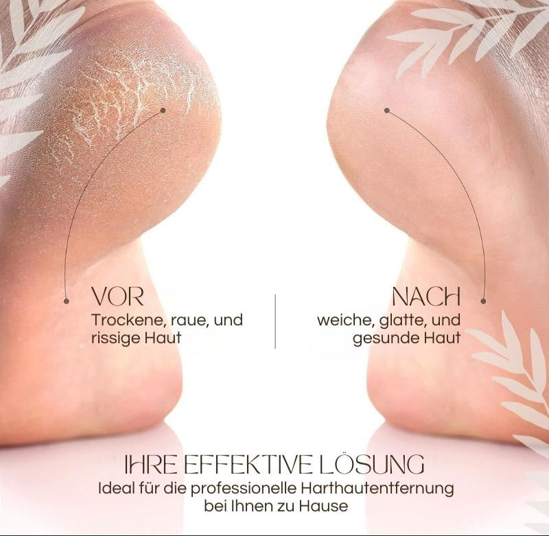 CallusPro™ | Elektrischer Hornhautentferner | Quarz-Kristallrollen | LED-Licht | Wasserdicht