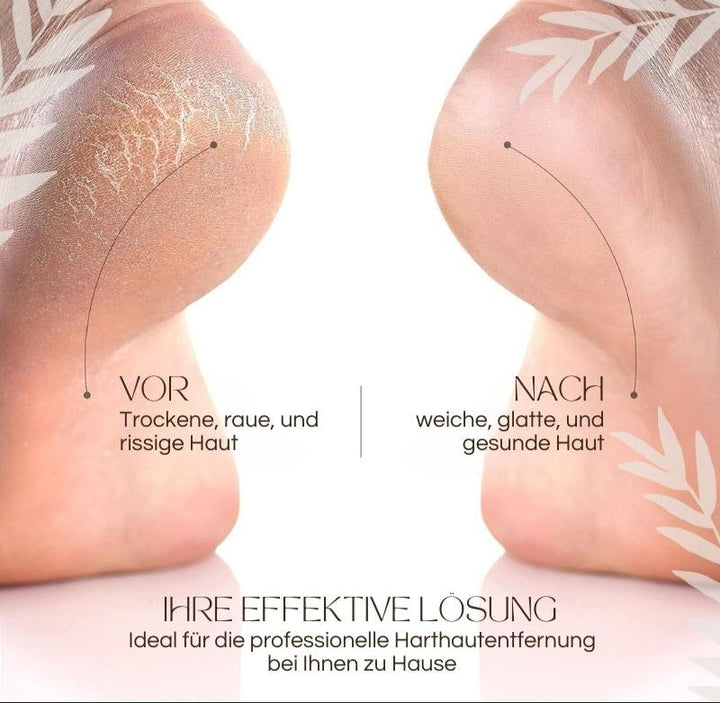 CallusPro™ | Elektrischer Hornhautentferner | Quarz-Kristallrollen | LED-Licht | Wasserdicht