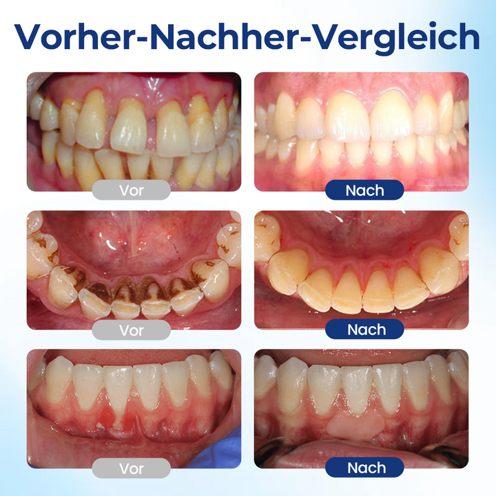 GumViva™ Mundtropfen für frischen Atem und zur Unterstützung des Zahnfleisches