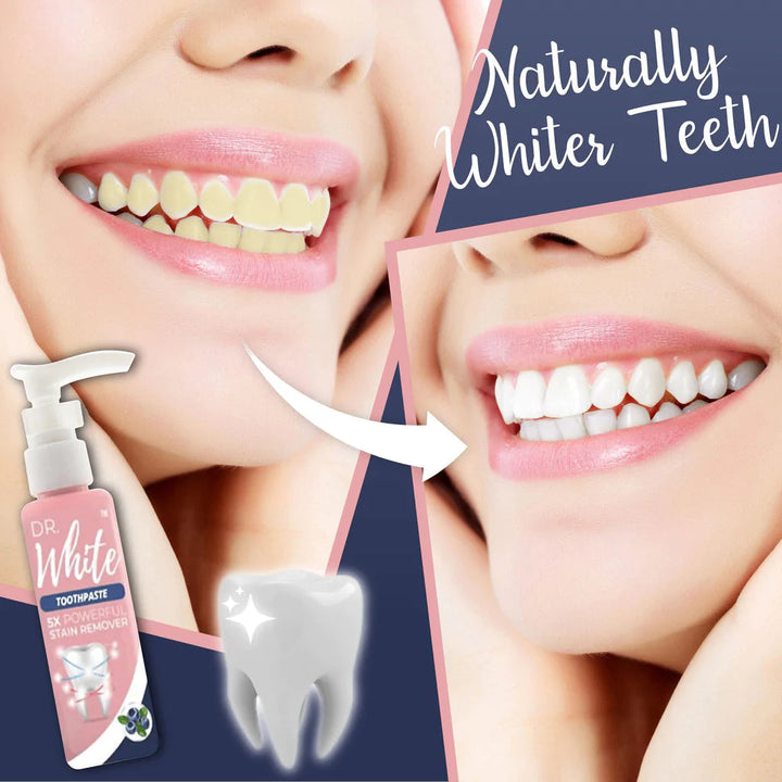 1 + 1 GRATIS HEUTE | CleanStain™- Jeden Tag ein schönes Lächeln haben!