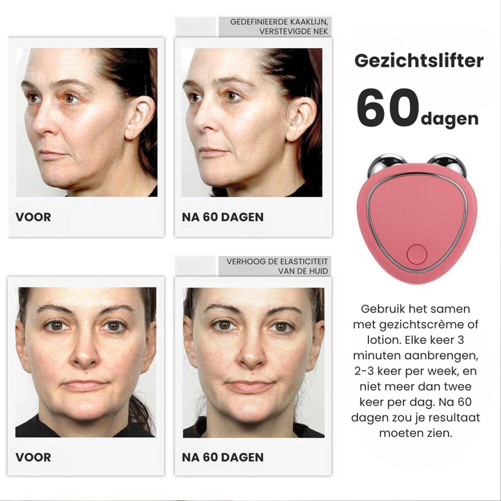 YouthNourish™ - Gesichtsmassagegerät