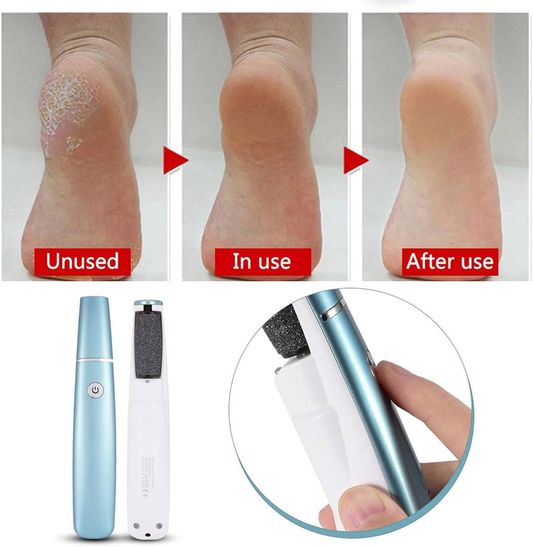 Pedilume™ | Elektrische Fußschleifmaschine Hornhautentferner