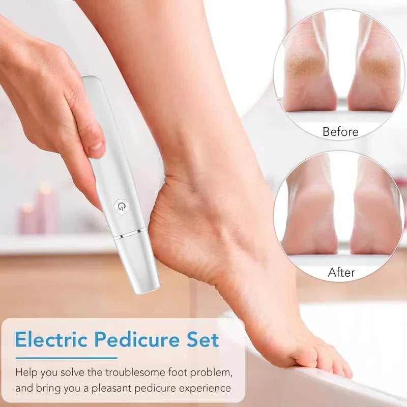 CallusRemove™ – Elektrischer Hornhautentferner für Weiche & Glatte Füße [50% Rabatt]