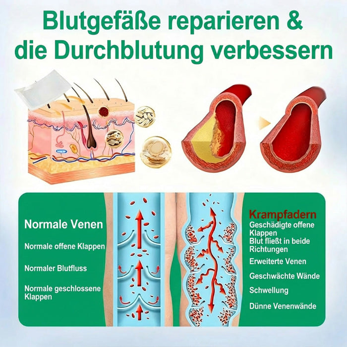 VenenSanft™ Mikronadel-Pflege für die Beine