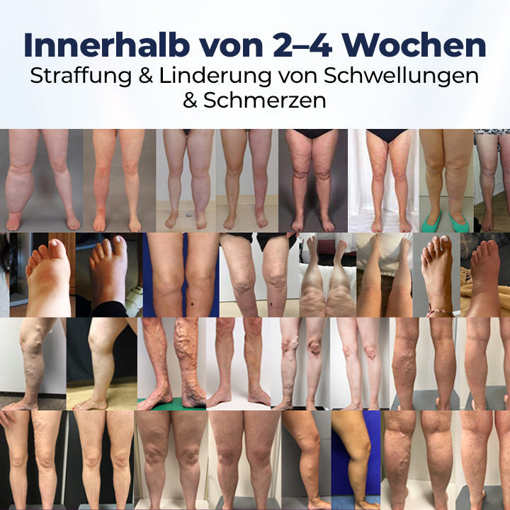 VenoEase™ Beincreme für ein leichtes, entspanntes Gefühl