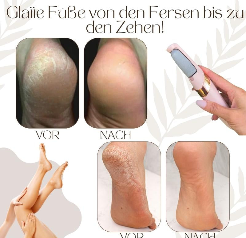 CallusPro™ | Elektrischer Hornhautentferner | Quarz-Kristallrollen | LED-Licht | Wasserdicht