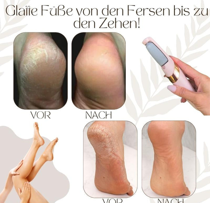 CallusPro™ | Elektrischer Hornhautentferner | Quarz-Kristallrollen | LED-Licht | Wasserdicht