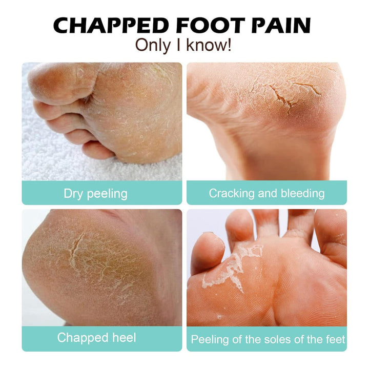 FootCream™ – Heilende und schützende Pflege für rissige Haut, für langanhaltenden Komfort [1 + 1 Gratis]