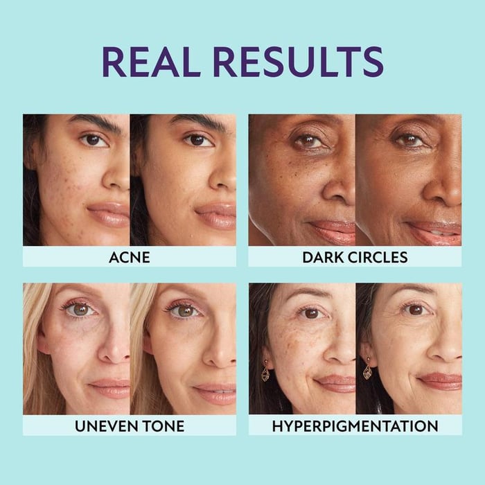 SupremeCrème™ – Feuchtigkeitsspendender Concealer mit natürlichem, makellosem Finish [50% Rabatt]