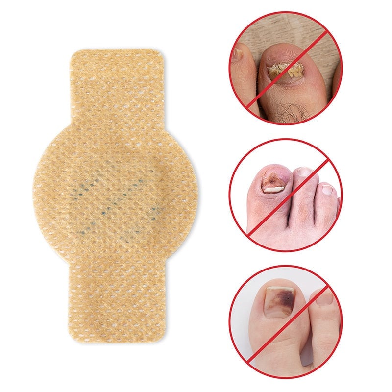 FungalPatch™ – Antibakterieller, schimmelhemmender Patch für effektive Nagelpflege [50% Rabatt]