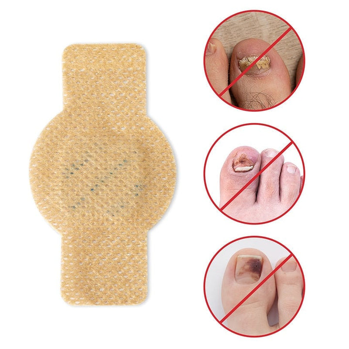 FungalPatch™ – Antibakterieller, schimmelhemmender Patch für effektive Nagelpflege [50% Rabatt]