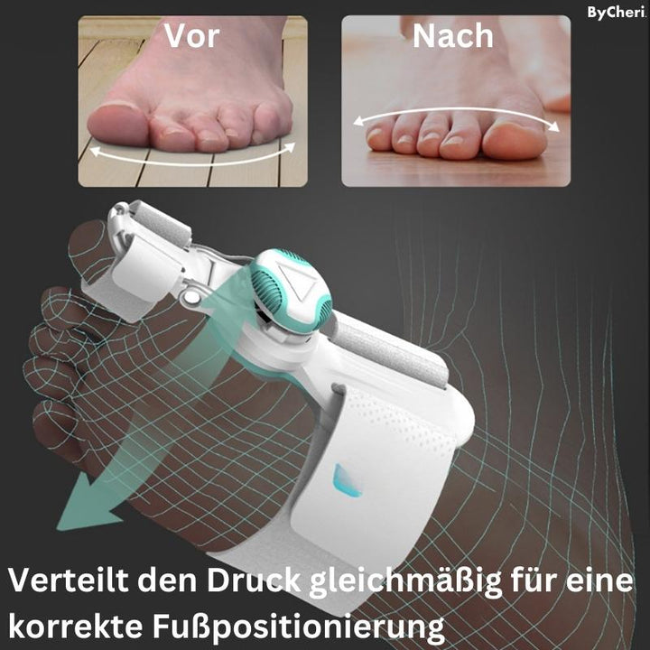 1+1 GRATIS TEMPORÄR | OrthoAlign™ – Großzehenkorrektor