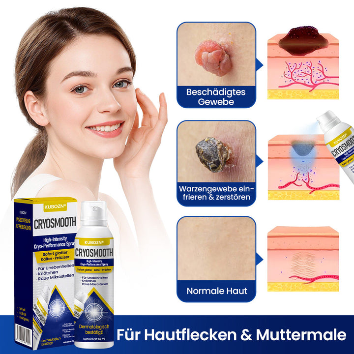 HautGlatt™ Kryo-Präzisionsspray gegen Hautunebenheiten