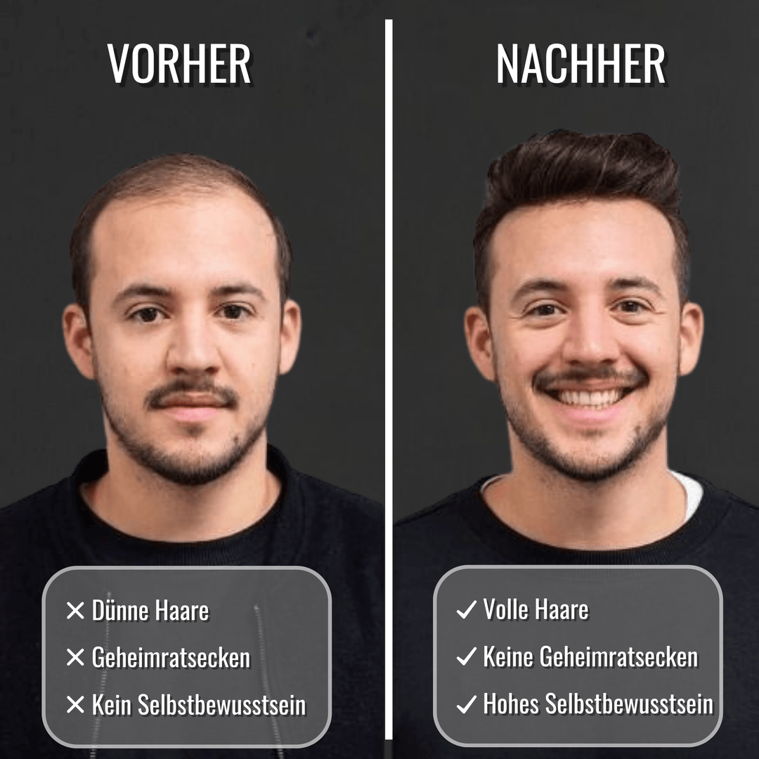 HaarKraft™ Pflegeöl für Männerhaar