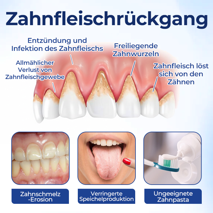 GumViva™ Mundtropfen für frischen Atem und zur Unterstützung des Zahnfleisches