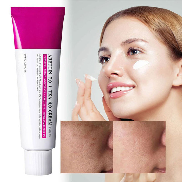 Elyzura™ – Crem gegen dunkle Flecken sanft, effektiv, aufhellend und sichtbar [1 + 1 Gratis]