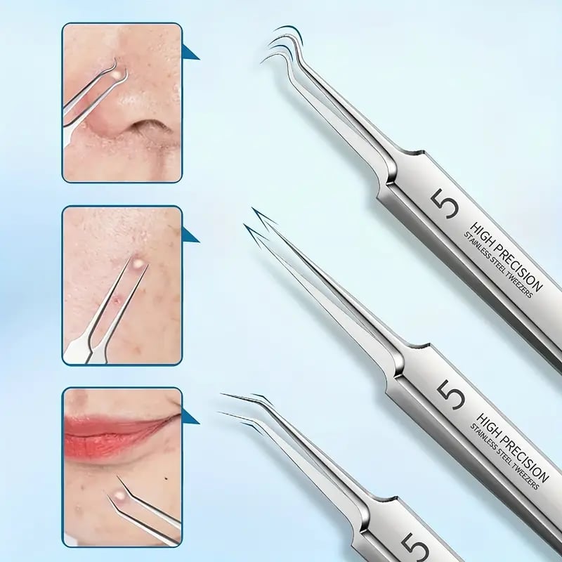 ClearPore™ – Mitesser-Pinzetten-Entferner-Set, präzise, effektiv, sicher & hygienisch [1 + 1 Gratis]
