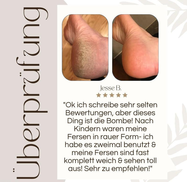 CallusPro™ | Elektrischer Hornhautentferner | Quarz-Kristallrollen | LED-Licht | Wasserdicht