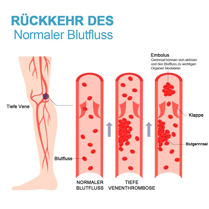 (1+2 Gratis) SlimmingSocks™ Schlanke Beine und straffe Haut in einem Schritt!