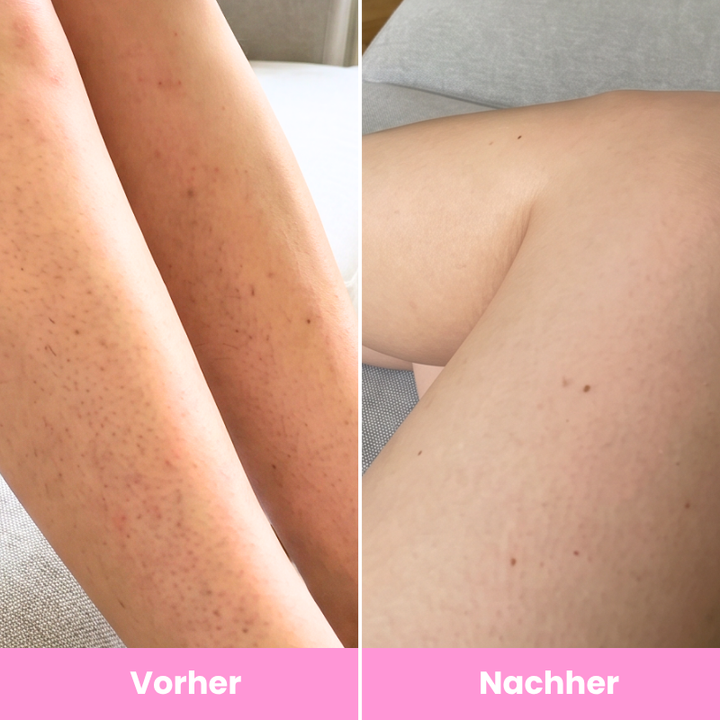 GlowEase™ Sommerpflege-Set