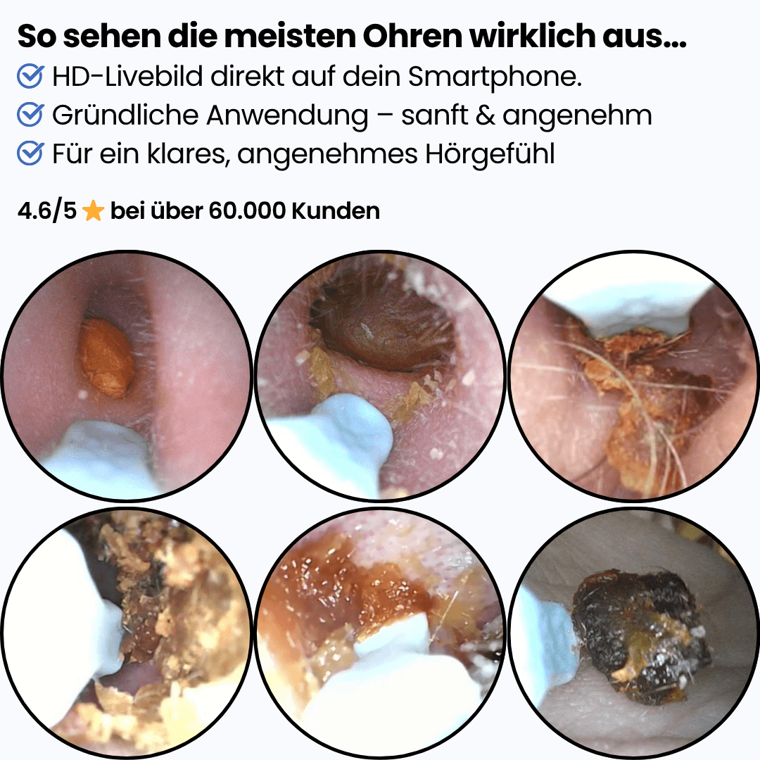 Earvia™ – Präziser Ohrreiniger mit Kamera für sanfte Pflege
