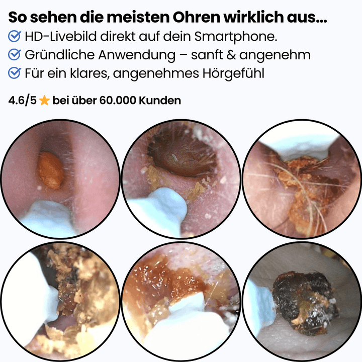 Earvia™ – Präziser Ohrreiniger mit Kamera für sanfte Pflege