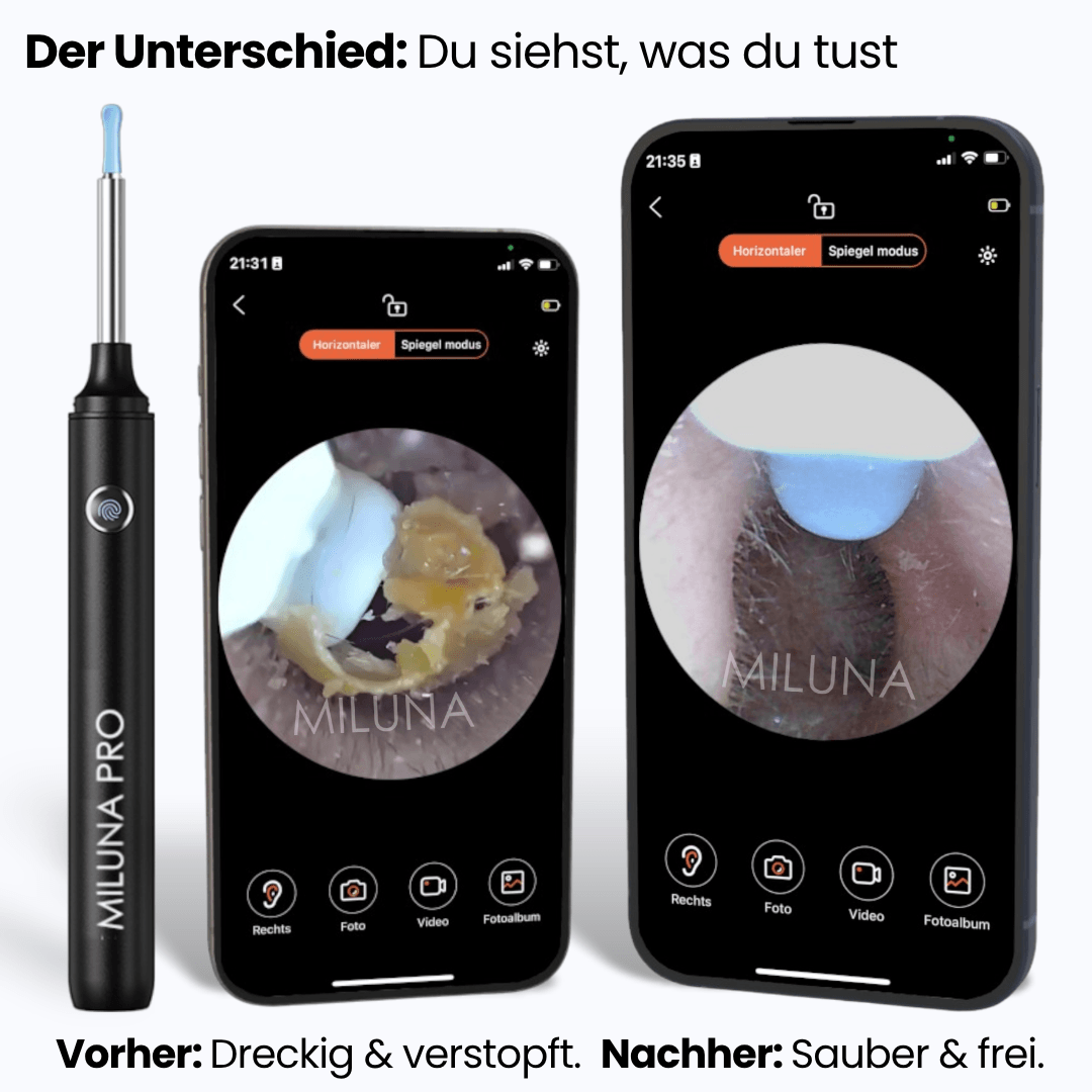 Earvia™ – Präziser Ohrreiniger mit Kamera für sanfte Pflege