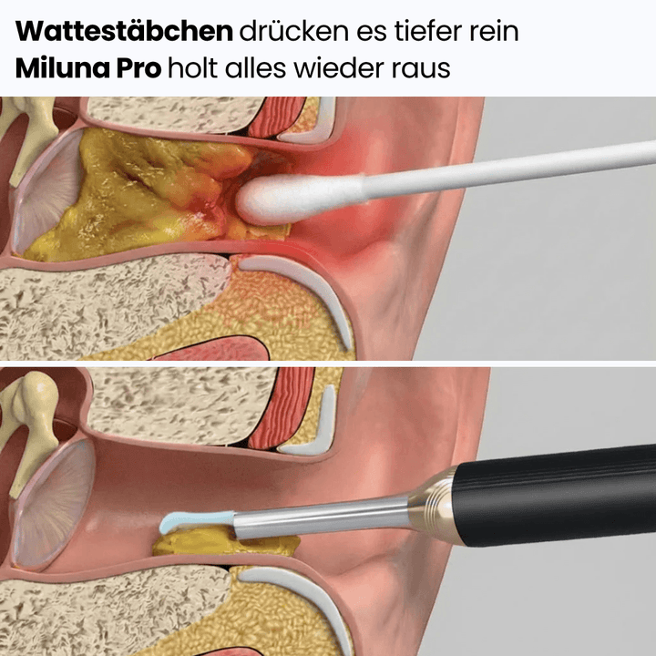 Earvia™ – Präziser Ohrreiniger mit Kamera für sanfte Pflege