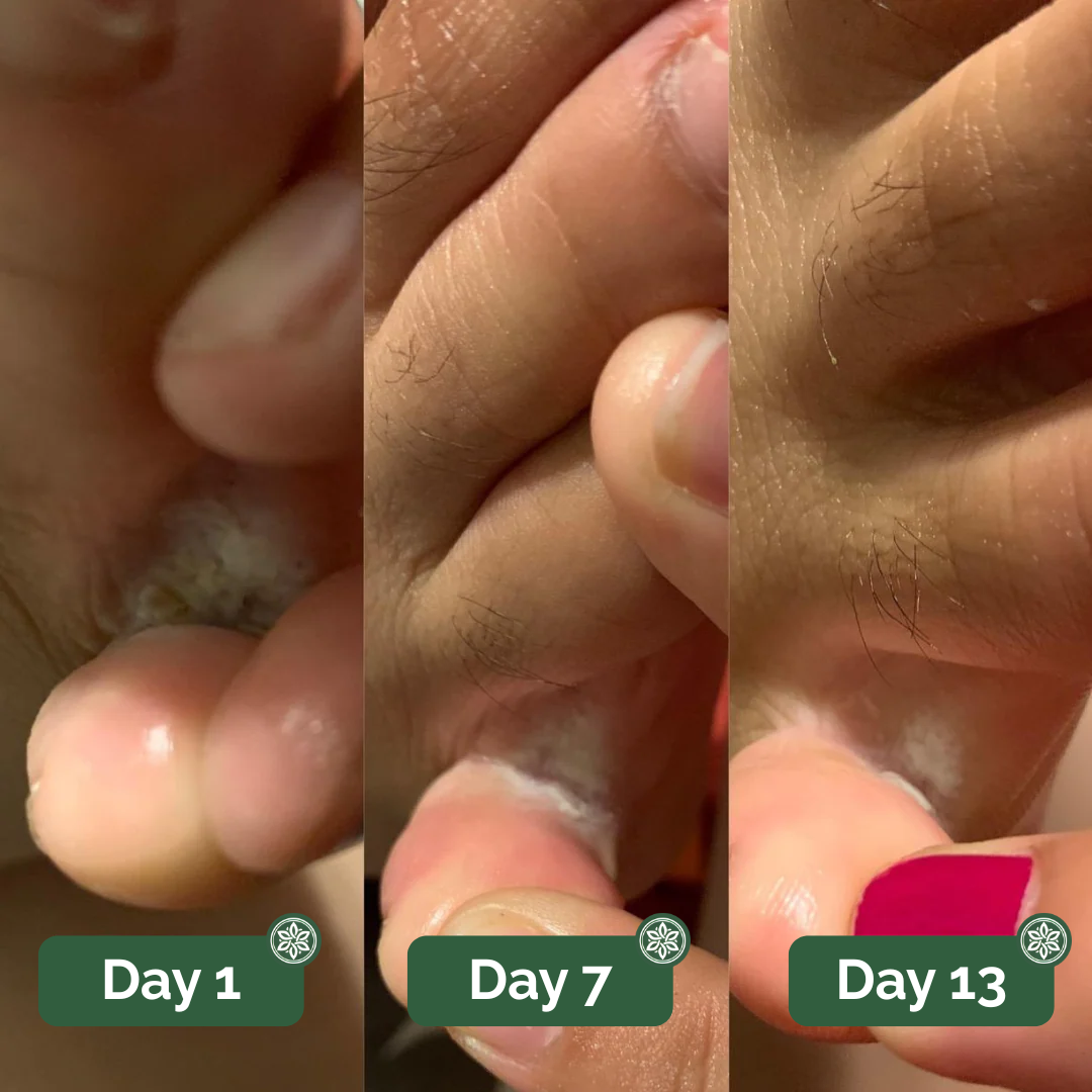 Veloma Antifungale Seife®