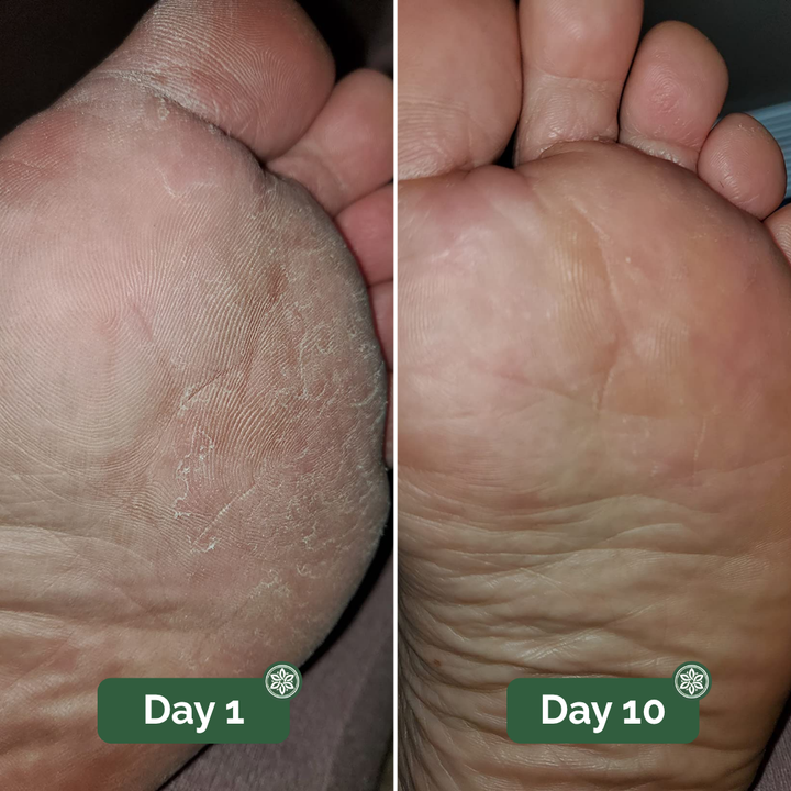 Veloma Antifungale Seife®