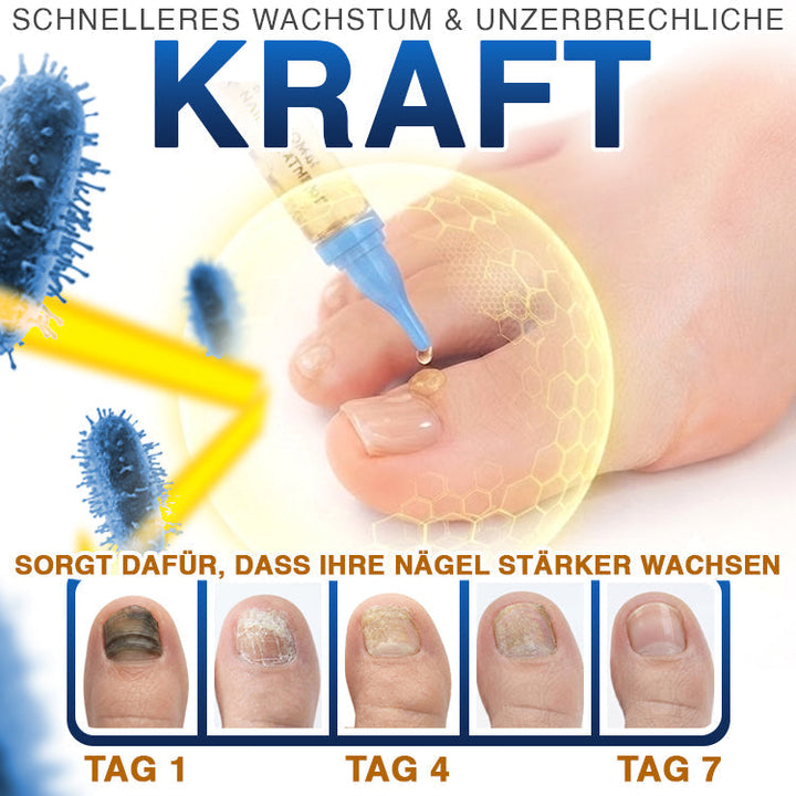 NailLuxe™ – Premium Nagelpflege mit Bienengift für schöne Nägel