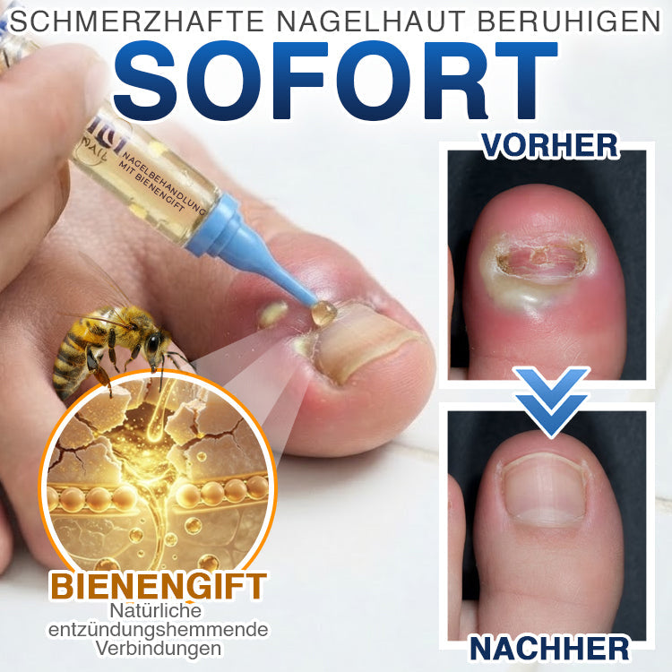 NailLuxe™ – Premium Nagelpflege mit Bienengift für schöne Nägel
