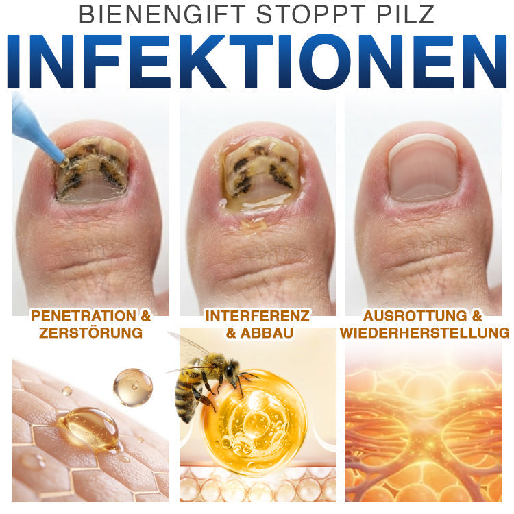 NailLuxe™ – Premium Nagelpflege mit Bienengift für schöne Nägel